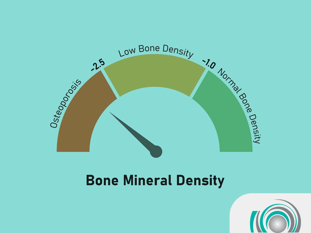 bone density